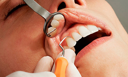 Dentística Dentística